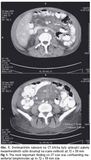 CSGH 4/2006